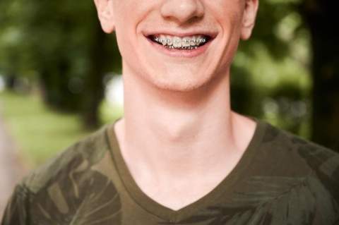 Damon brekid